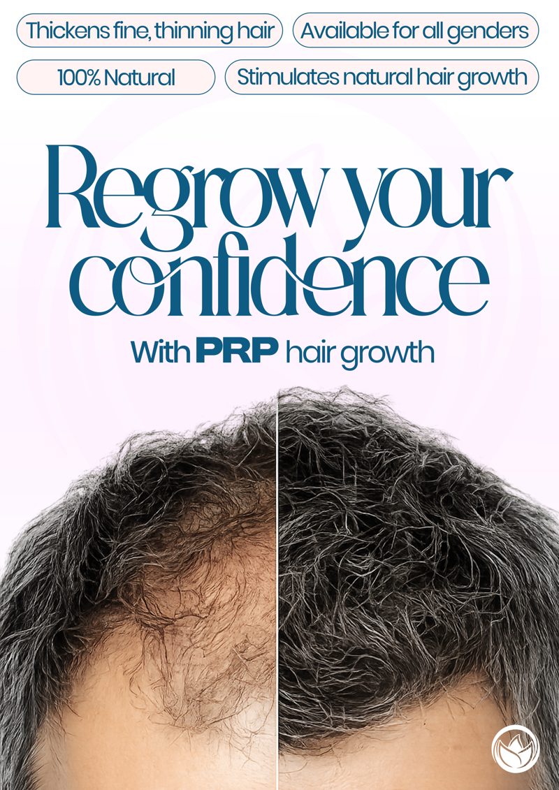PRP hair growth poster